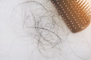 what causes hair loss in women