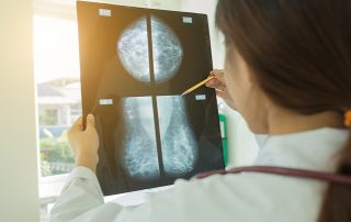 breast lump, breast cancer