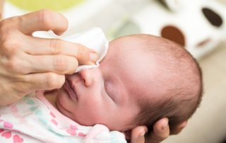 symptoms of conjunctivitis