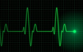 are palpitations serious?