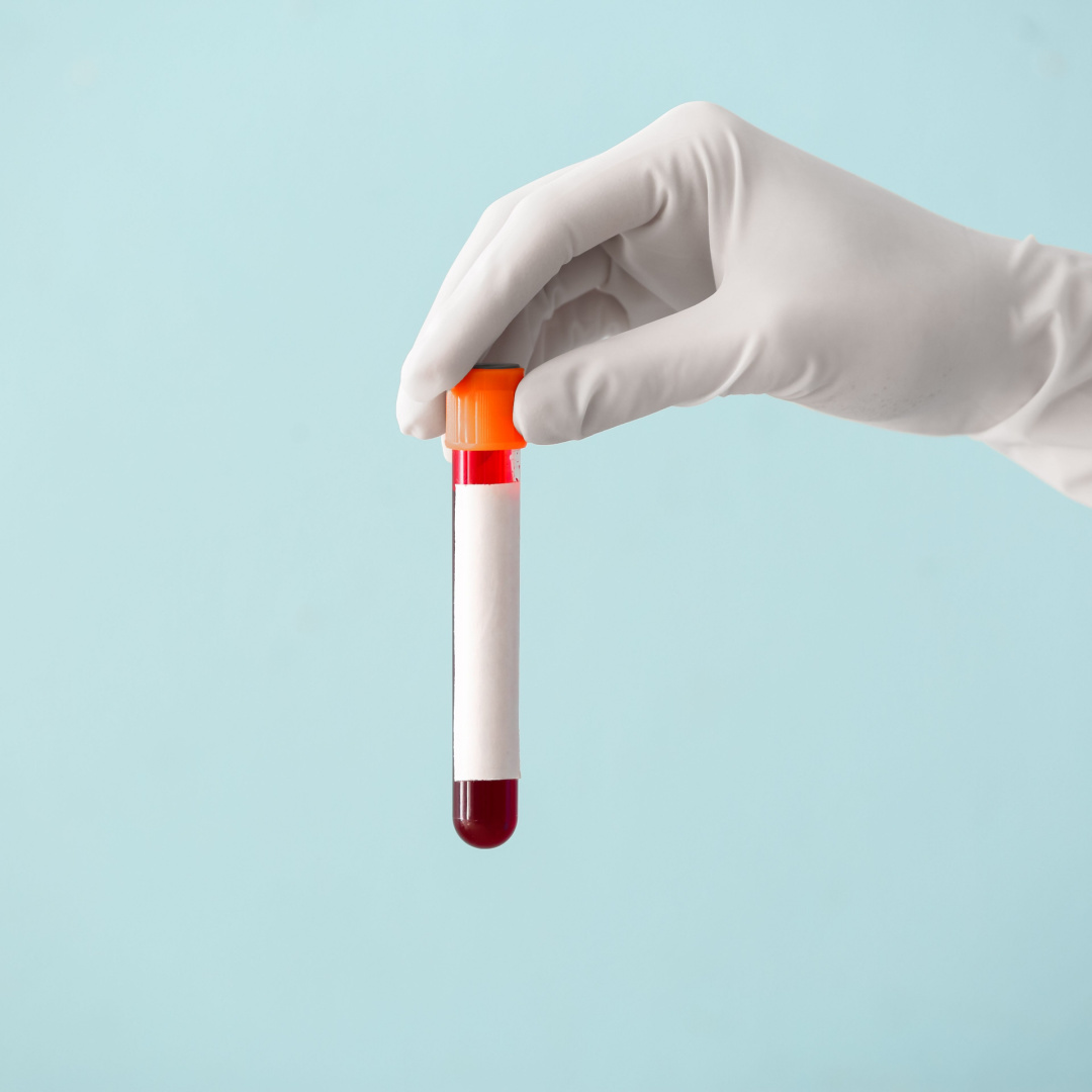 extended-urine-blood-sti-tests-qoctor-your-quick-online-doctor