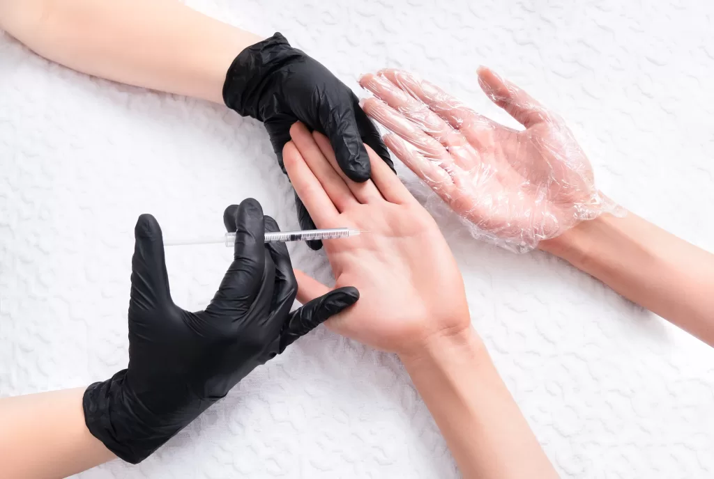 Injection of a preparation containing botulinum toxin in palm to treat hyperhidrosis
